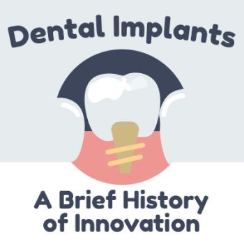 Houston dentist, Dr. Dassani of Dassani Dentistry discusses dental implants and shares some information about their history.